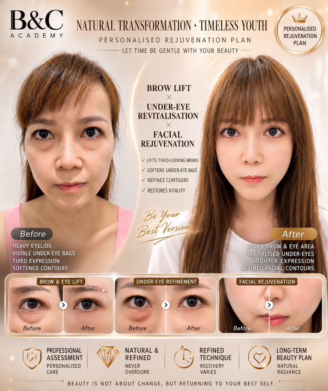 Integrated facial and eye rejuvenation